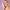 Skin Bleaching Cream for Dark Skin Lightening Underarm Whitening Cream Contain Vitamin C for Armpit, Knees, Elbows, Inner Thighs, and Bikini Area (1.76 fl.oz)