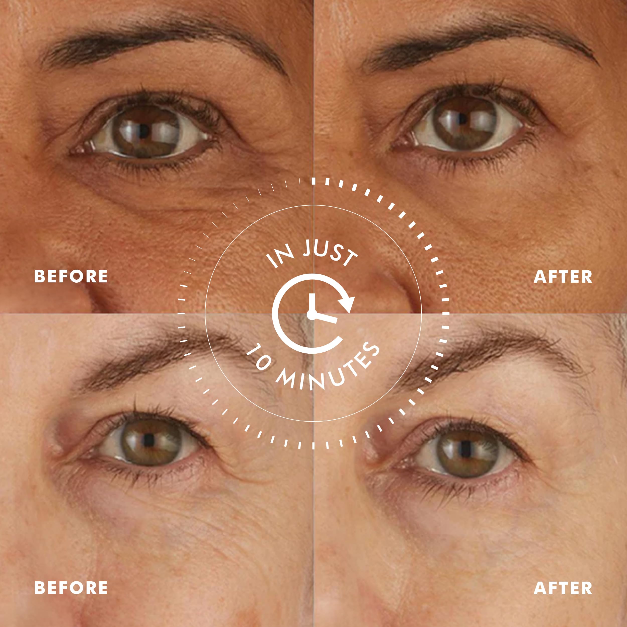 skyn ICELAND Hydro Cool Firming Under Eye Patches, Instant Cooling for Puffy, Tired Eyes with Peptides and Coenzyme Q10, 10 Minute Treatment, Vegan, All Skin Types, 4 Pairs